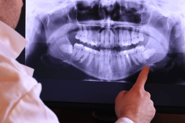 Best Emergency Tooth Extraction  in Griggsvle, IL