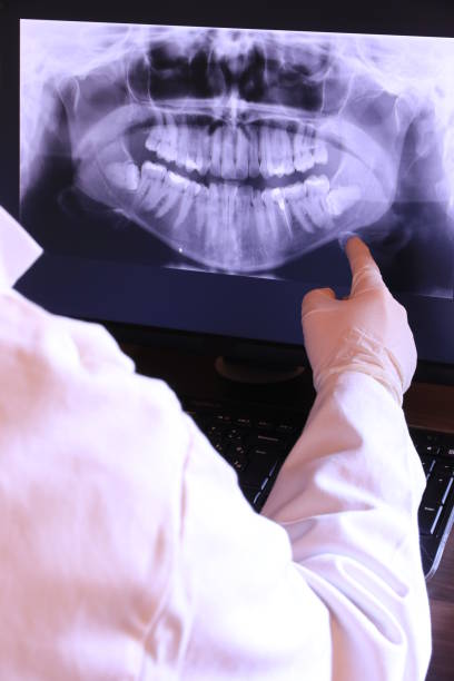 Best Root Canal Emergency Dentist  in Griggsvle, IL