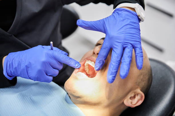Best Dentist for Tooth Abscess  in Griggsvle, IL