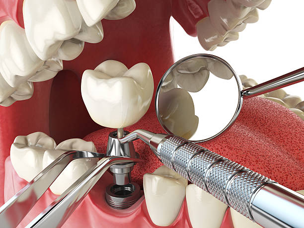Best Emergency Gum Pain Relief  in Griggsvle, IL